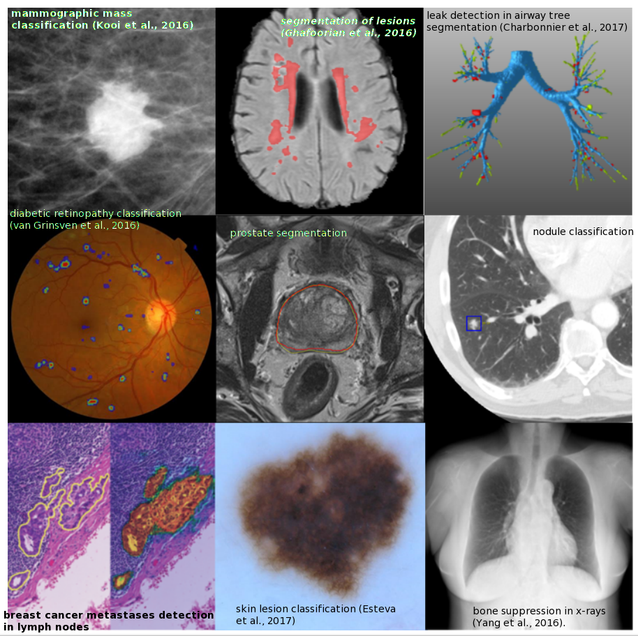 Collage of medical imaging applications of DL